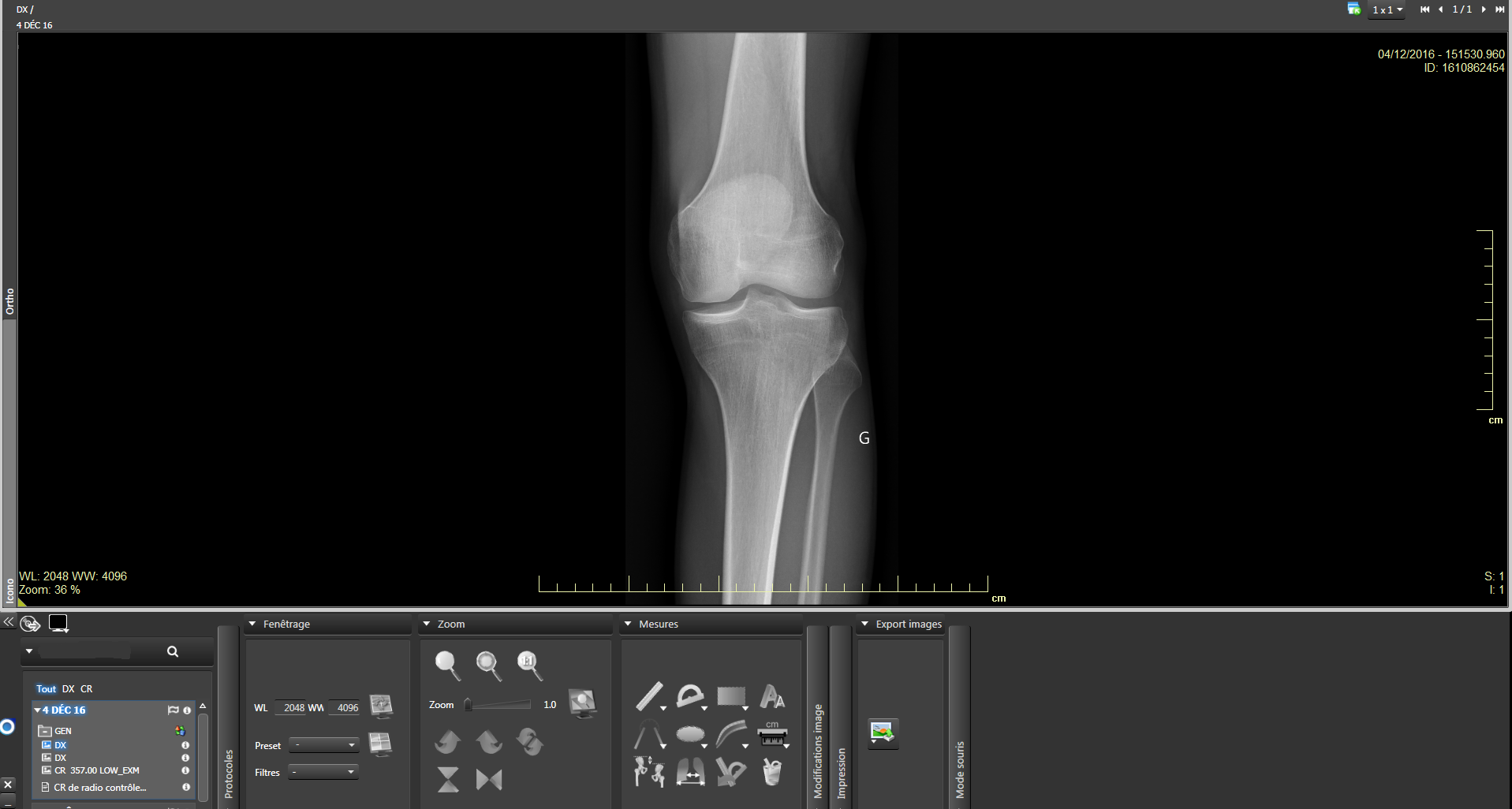 diffusion patient radiologie rennes